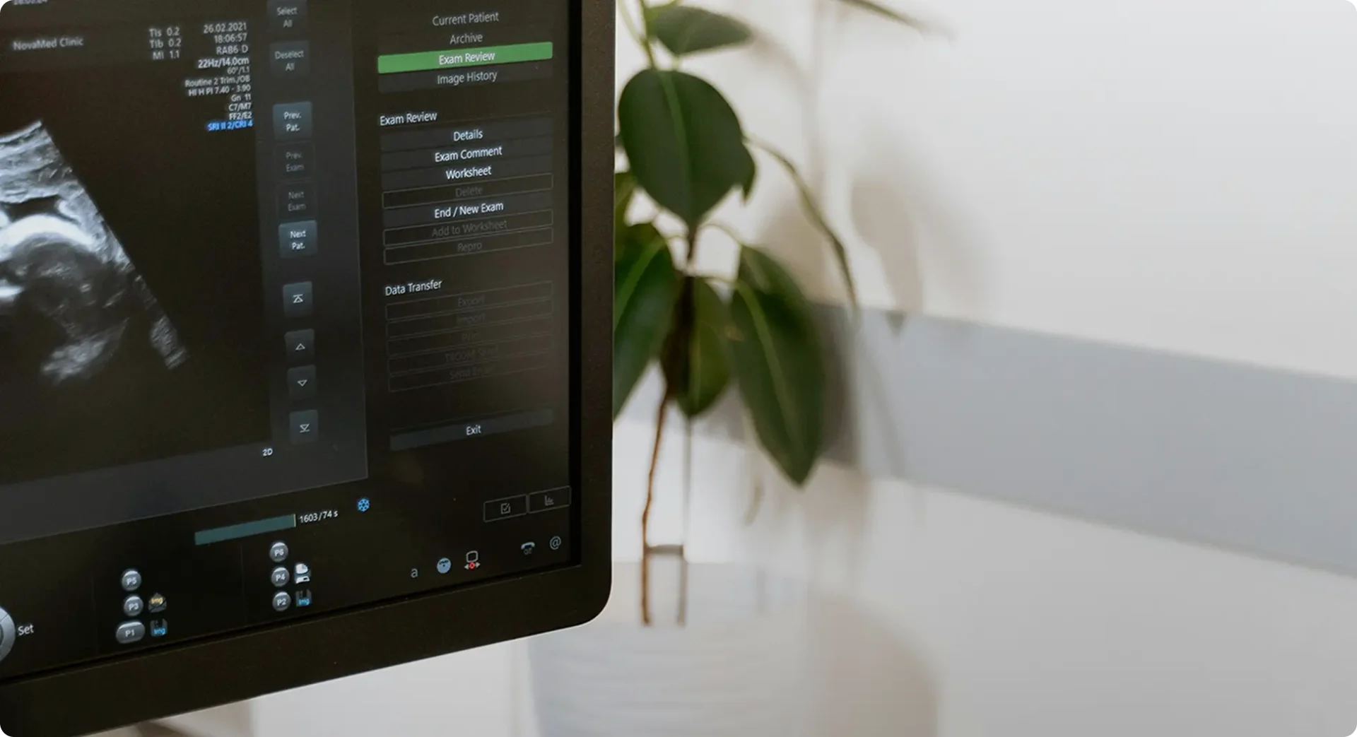 Close-up of a screen showing an ultrasound interface